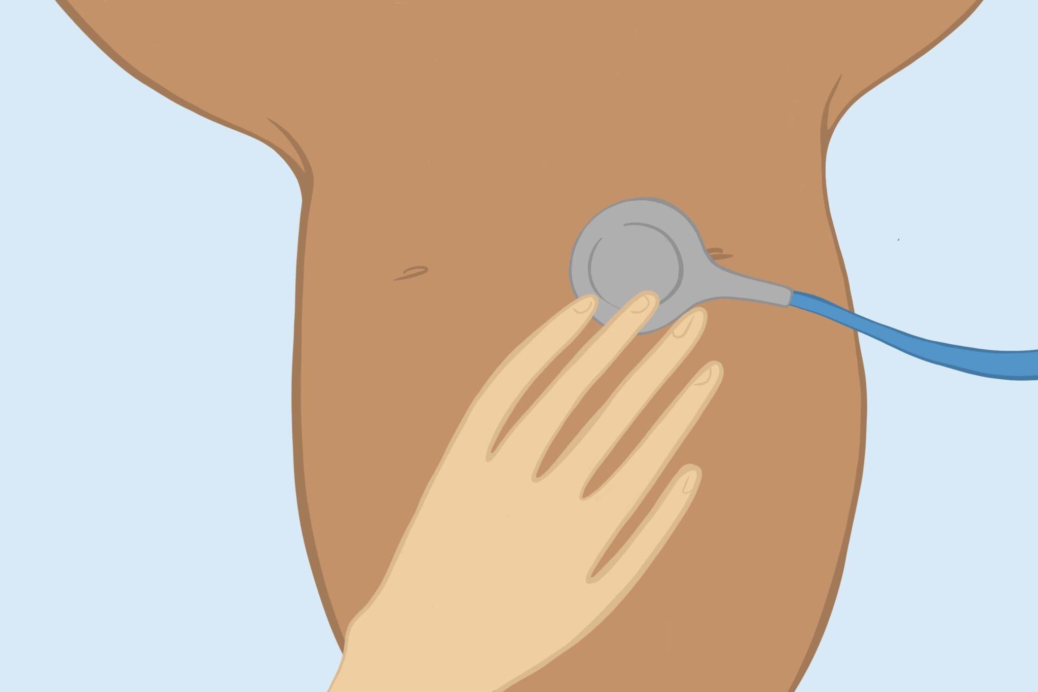 Screening for congenital heart disease in newborns